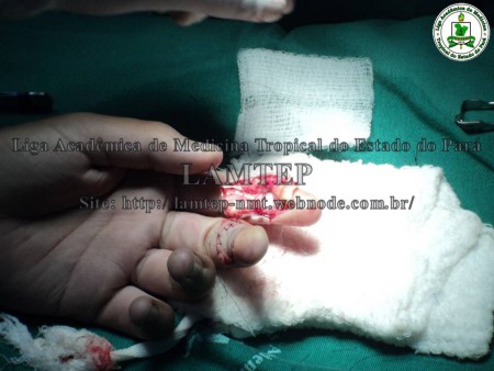 Cirurgia 08-06-2012